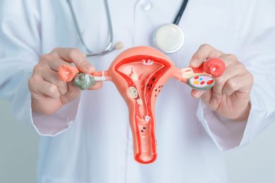 Polycystic Ovary Syndrome